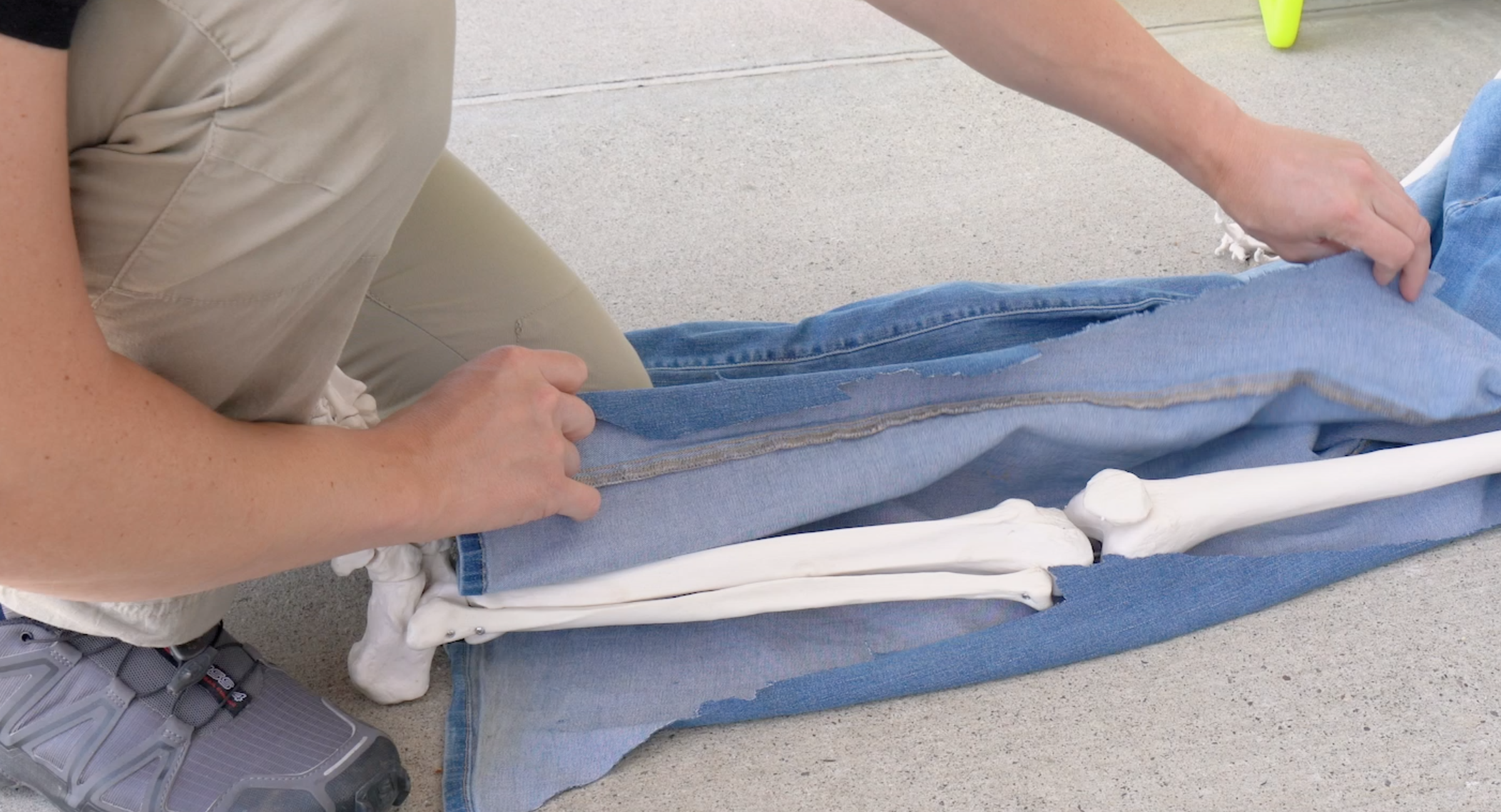 NREMT Practical Skills How-To: Extremity Splinting - Knee Or Tibia/Fibula